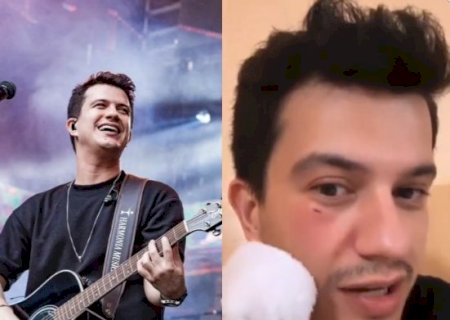 Sertanejo Hugo mostra como ficou seu rosto após ser atingido por celular em show