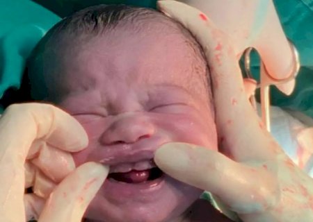 Bebê surpreende pais e equipe médica ao nascer com seis dentes em maternidade de Campo Grande