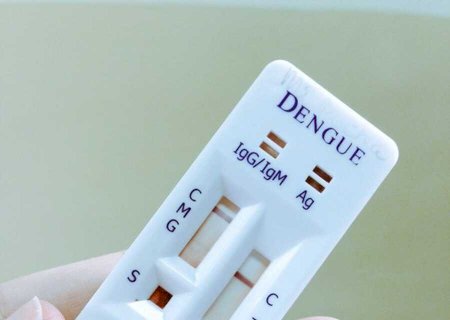 MS terá teste rápido inédito para diagnóstico de dengue na rede pública>