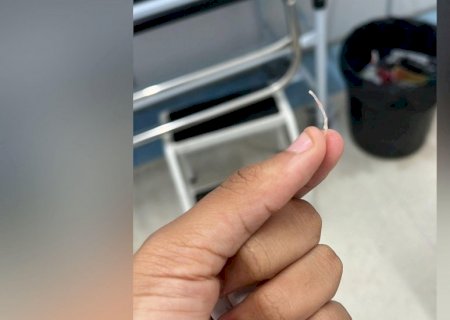 Mulher tem esôfago perfurado ao engasgar com espinha de peixe e morre em MS