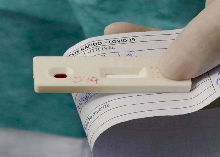 Mato Grosso do Sul registra primeira morte por Covid-19 em 2026>