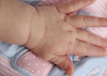 Bebê estuprado e agredido por padrasto morre na Santa Casa de Campo Grande>