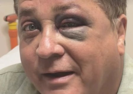 Pescaria no Pantanal terminou com Leonardo de olho roxo: “Tá bonito, não?”