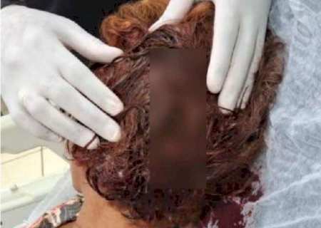 "Para servir de exemplo": traficantes torturam mulher por d&iacute;vida de R$ 50
