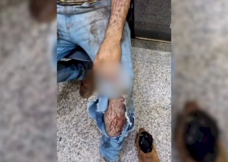 Trabalhador relata ter sido atacado por onça durante colheita